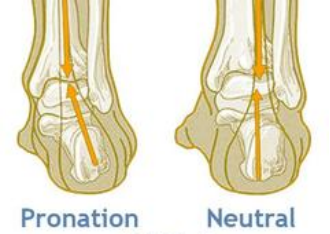 Flat foot outlet supination